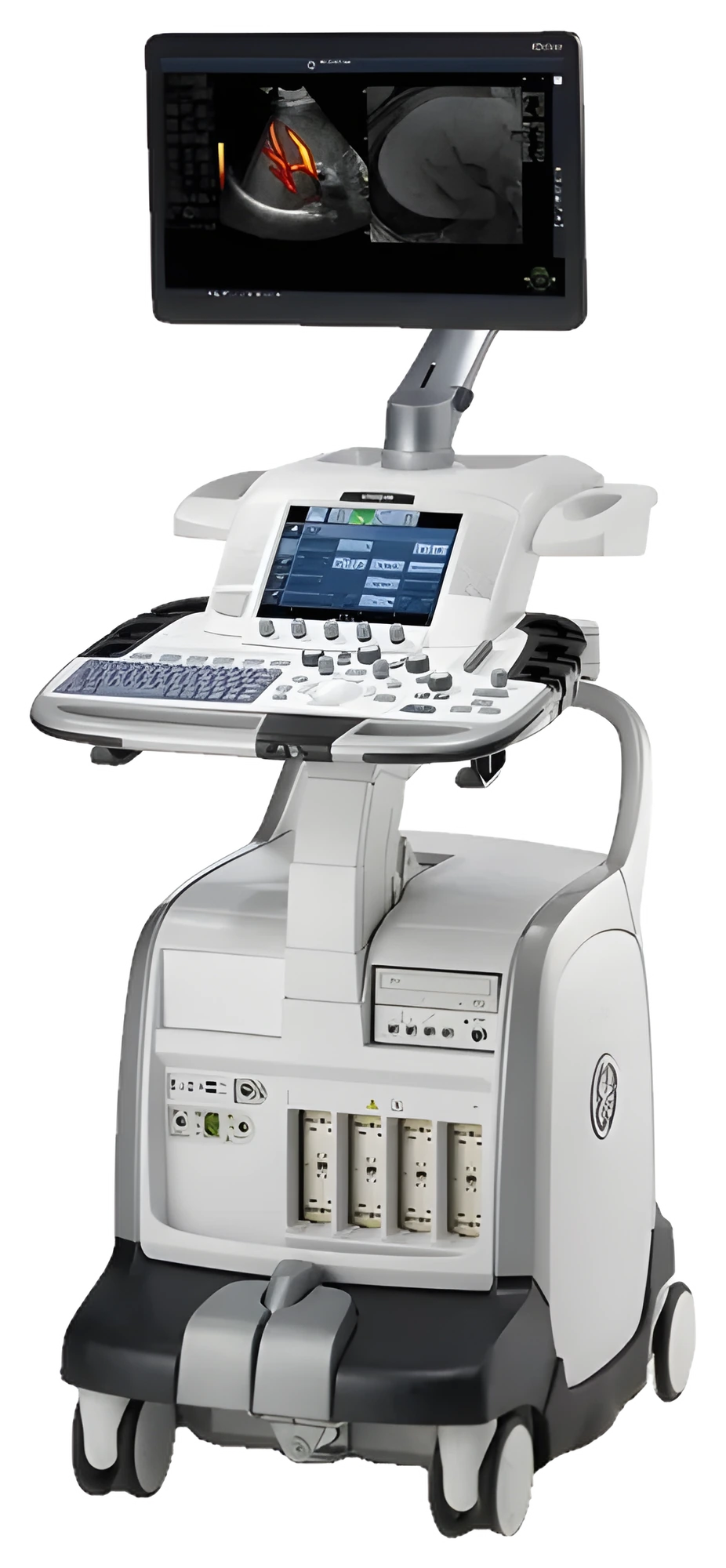 IMAGE SLOT: STRESS ECHO — DYNAMIC ECHOCARDIOGRAPHY